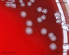Yersinia pestis colony morphology